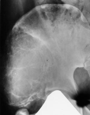 Variant appearance. A 45-year-old man with right h