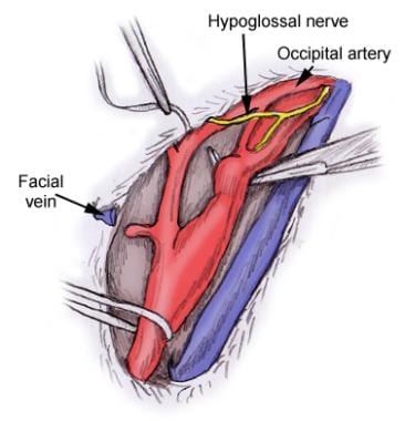 Common facial vein branch of internal jugular vein