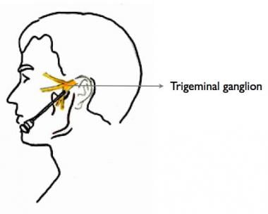 Direction of needle entry for gasserian ganglion b