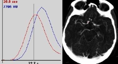 Placement of ROI curves on arterial and venous pix