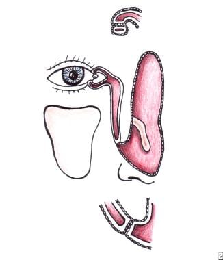 Nasolacrimal System Anatomy: Embryology, Puncta, Canaliculi