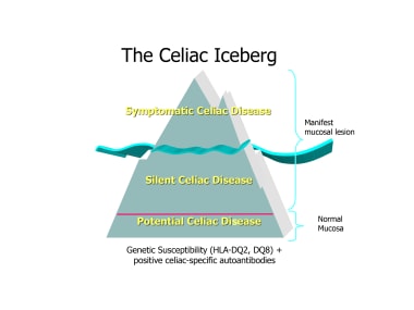 The celiac iceberg. 