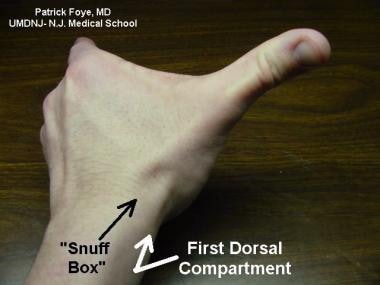 First dorsal compartment of wrist includes tendon