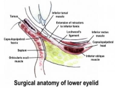 Lower eyelid anatomy. 