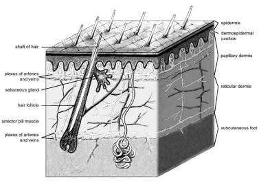 Tissue Adhesive  Sutures and Skin Closures