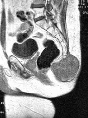 Sagittal contrast-enhanced T1-weighted magnetic re