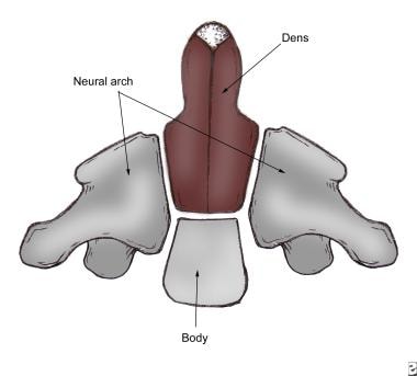 Os Odontoideum: Practice Essentials, Anatomy, Pathophysiology