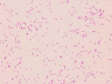 Gram stain of Yersinia enterocolitica.