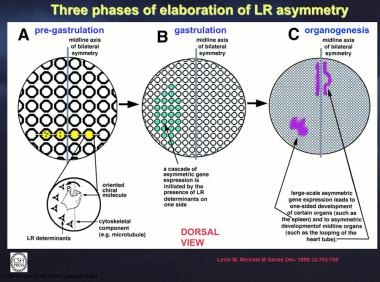 Three phases of elaboration of left-right (LR) asy