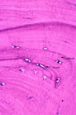 显微图显示骨细胞位于骨陷窝中。细纹