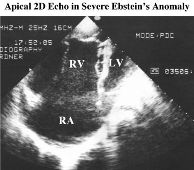 The 2-dimensional echocardiogram shows many of the