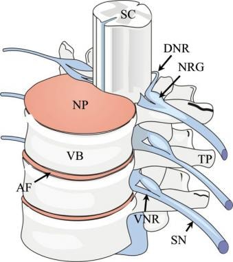 Thoracic spine trauma. Drawing of the thoracolumba