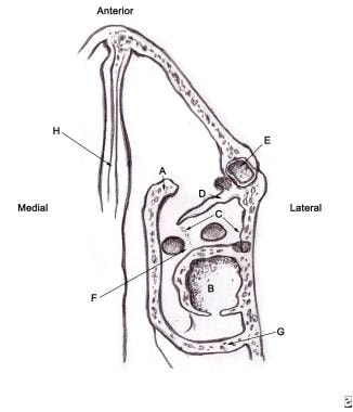 Axial section through right nasal cavity depicts t
