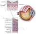 Retinal Detachment