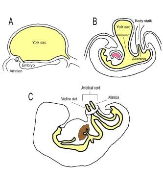 Cartoon illustrating the developing umbilical cord