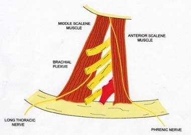 Thoracic outlet obstruction. Scalene triangle. 