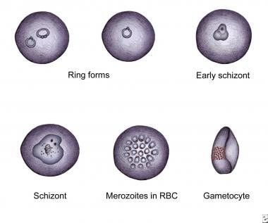 The various stages of Plasmodium falciparum as obs