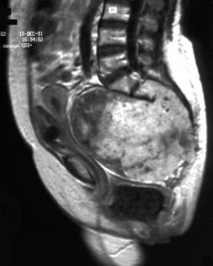 Sagittal contrast-enhanced T1-weighted magnetic re