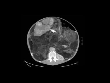 Contrast-enhanced, axial computed tomography (CT) 