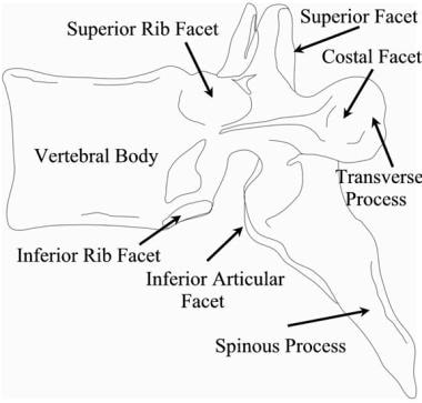 Thoracic spine trauma. Drawing of a typical thorac