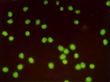 P-ANCA immunofluorescence pattern. Perinuclear ant