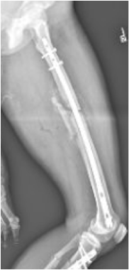Lateral radiograph of a healing femoral shaft frac
