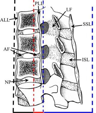 Thoracic spine trauma. Sagittal drawing of the tho