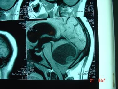 A 28-year-old female patient presented with headac