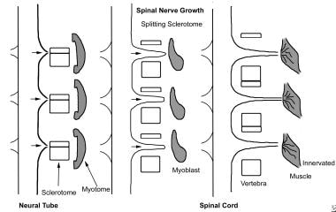 Vertebral morphogenesis; each vertebral sclerotome