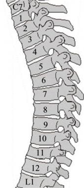 Thoracic spine trauma. Twelve similar thoracic ver