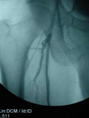 A 52-year-old male with right lower extremity inte