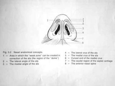 Nasal anatomy, base. Image used with permission. 