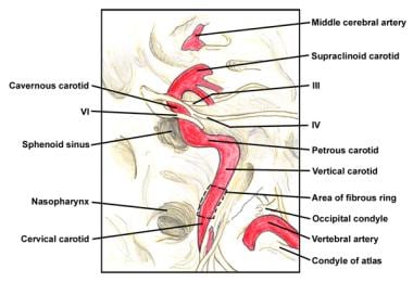 Intracranial course of the internal carotid artery
