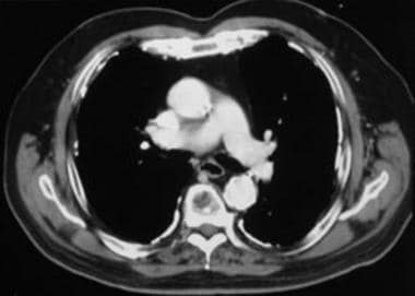 Case 1. Contrast-enhanced computed tomography (CT)