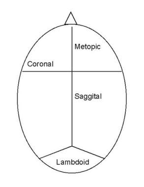 Diagram of a neonate's skull demonstrating the loc