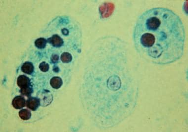 Trichrome stain of Entamoeba histolytica trophozoi