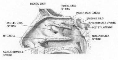 侧鼻墙展示的矢状部分