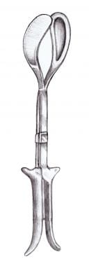 An illustration of Kjelland forceps with a Luikart