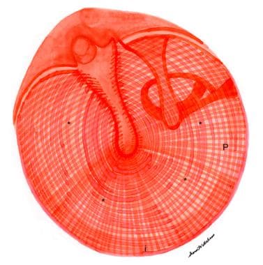 Drawing of normal right tympanic membrane. Note ou