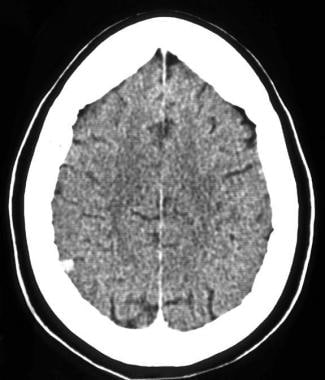 Case 2: CT scan of a 40-year-old patient with a si