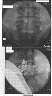 Oblique "Scotty Dog" view is shown in the bottom r