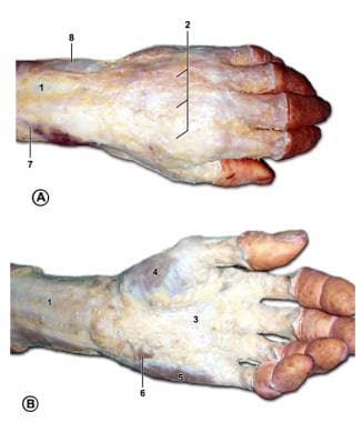 Subcutaneous structures of the left hand. A is the