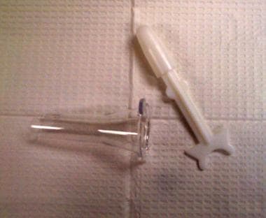 Plastic disposable anoscope with obturator removed