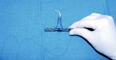 Stitches (Sutures) 101: Overview, Types, Procedures & Removal - Homage