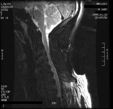A 48-year-old man presented with neck pain and pre