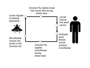 Simplified life cycle of Onchocerciasis volvulus.
