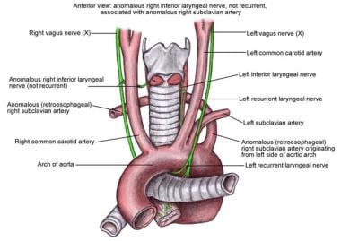 thyroidectomy anatomy