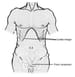 Abdominal Closure