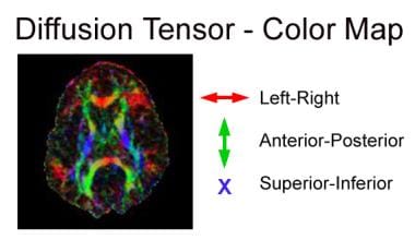 Diffusion Tensor Imaging: Practice Essentials, Tensor and