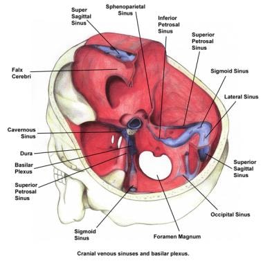 Cranial venous sinuses and the basilar plexus. 